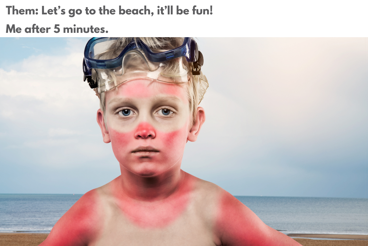 Little boy with a sunburn